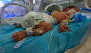 تشوه الاجنة