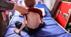 سوء التغذية