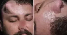 عملية جراحية معقدة