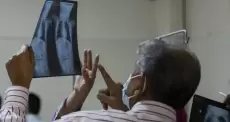 الحصبة