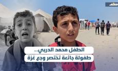 الطفل محمد الدربي.. طفولة جائعة تختصر وجع غزة