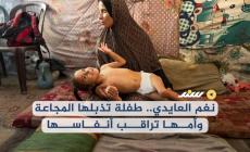 نغم العايدي.. طفلة تُذبلها المجاعة وأمها تراقب أنفاسها