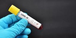 1584353446test-coronavirus_bNho9RC.image_corps_article.jpg
