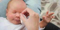أعراض انسداد القناة الدمعية عند الرضع