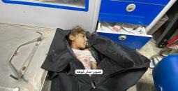 طفلة شهيدة