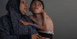 طفل غزي مصاب بشلل دماغي معاناته تتفاقم مع إغلاق المعابر