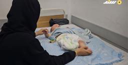 الرضيع هاني.. بُترت ساقه قبل أن يخطو أولى خطواته