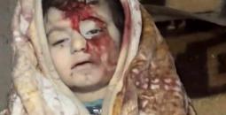 طفلة شهيدة في قصف حي الشيخ رضوان
