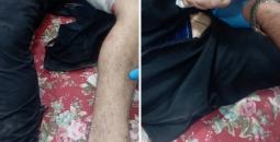 إصابة في إذنا