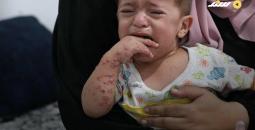 غزة