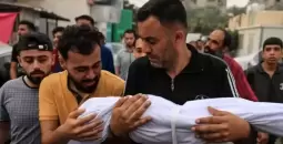 سوء تغذية