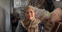 سوء التغذية
