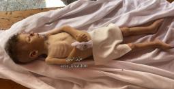 الطفل سيف حلس شهيد جراء المجاعة.jpg