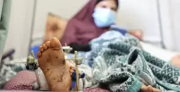 جرحى غزة.webp