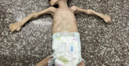 وفيات سوء التغذية.png