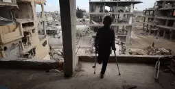 طفل جريح مبتور القدم