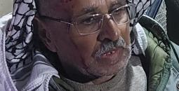 مستوطنون اعتداء
