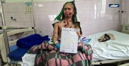 عبد الله الرقب.. رصاصة الاحتلال فجّرت مرضًا نادرًا ينهش جسده وسط عجز طبي في غزة