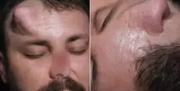 عملية جراحية معقدة