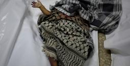 وصول جثامين 20 شهيدًا بينهم أطفال إلى مجمع الشفاء الطبي