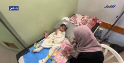 مريم تُصارع جراح الحروق ويتم الاستشهاد في غزة المحاصرة