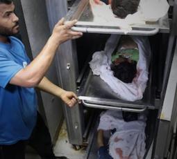 وصول عشرات الإصابات لمستشفى أبو يوسف النجار نتيجة مجزرة الاحتلال في حي الشعوت برفح