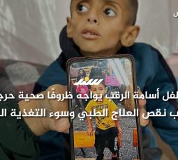 الطفل أسامة الرقب يواجه ظروفًا صحية حرجة بسبب نقص العلاج الطبي وسوء التغذية الحاد