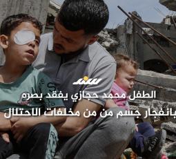 الطفل محمد حجازي يفقد بصره بانفجار جسم من من مخلفات الاحتلال في جباليا