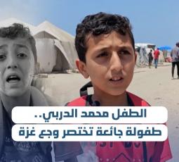 الطفل محمد الدربي.. طفولة جائعة تختصر وجع غزة