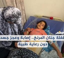 الطفلة جنان المرنخ.. إصابة وعجز جسدي دون رعاية طبية