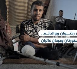 منصور رضوان ووالدته.. قدمان مبتورتان وجرحان غائران