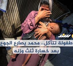 طفولة تتآكل.. محمد يصارع الجوع بعد خسارة ثلث وزنه