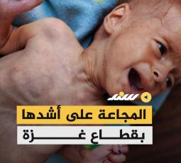 المجاعة على أشدها بقطاع غزة
