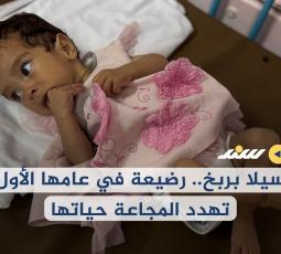 سيلا بربخ.. رضيعة في عامها الأول تهدد المجاعة حياتها