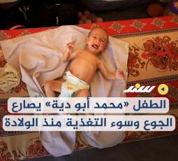 الطفل «محمد أبو دية» يصارع الجوع وسوء التغذية منذ الولادة