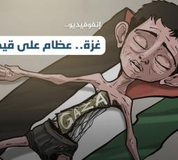 غزة.. عظام على قيد الحياة!