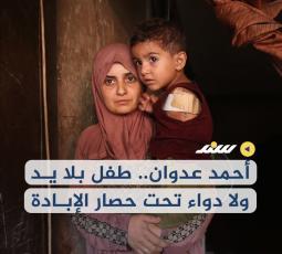 أحمد عدوان.. طفل بلا يد ولا دواء تحت حصار الإبادة