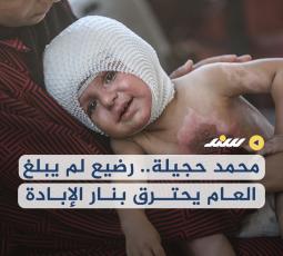 محمد حجيلة.. رضيع لم يبلغ العام يحترق بنار الإبادة
