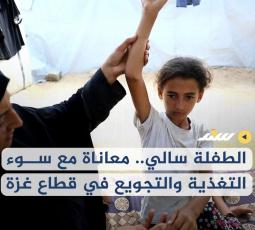 الطفلة سالي.. معاناة مع سوء التغذية والتجويع في قطاع غزة