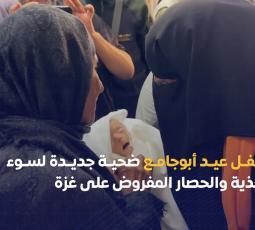 الطفل عيد أبو جامع.. ضحية جديدة لسوء التغذية والحصار على غزة