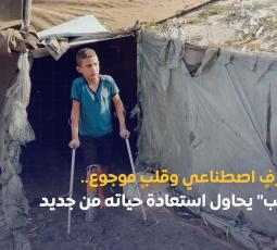 بطرفٍ اصطناعي وقلبٍ موجوع.. 