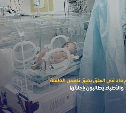 تورم حاد في الحلق يعيق تنفس الطفلة دعاء والأطباء يطالبون بإجلائها