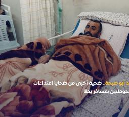 محمد أبو صبحة.. ضحية أخرى من ضحايا اعتداءات المستوطنين بمسافر يطا