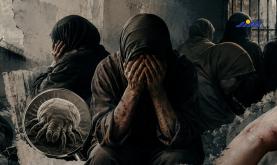 مرض السكابيوس ينتشر في صفوف الأسيرات والقلق يرهق أهاليهن