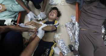 أطفال غزة المصابين.jpg