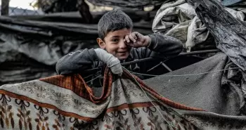 طفل فلسطيني مصاب بقصف الاحتلال في قطاع غزة.webp