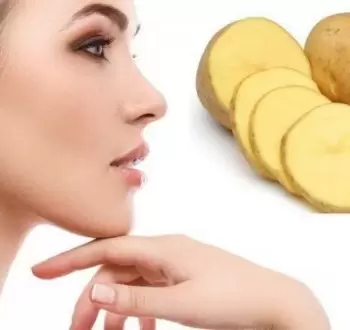 شرائح البطاطس
