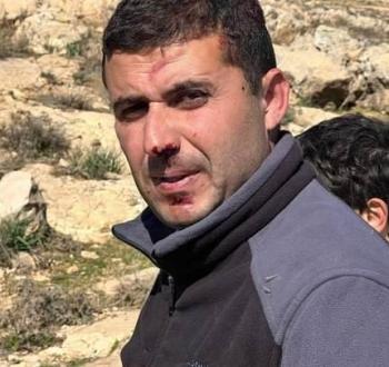 الاعتداء على فلسطيني في مسافر يطا.jpg