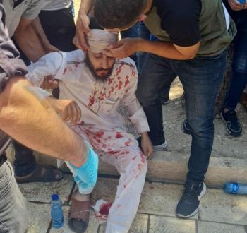 اعتداء على المصلين في باب الأسباط