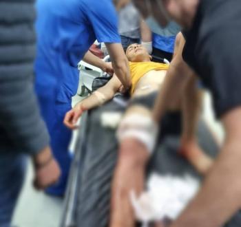 أسلحة حرارية في غزة تُسبب حروقًا قاتلة